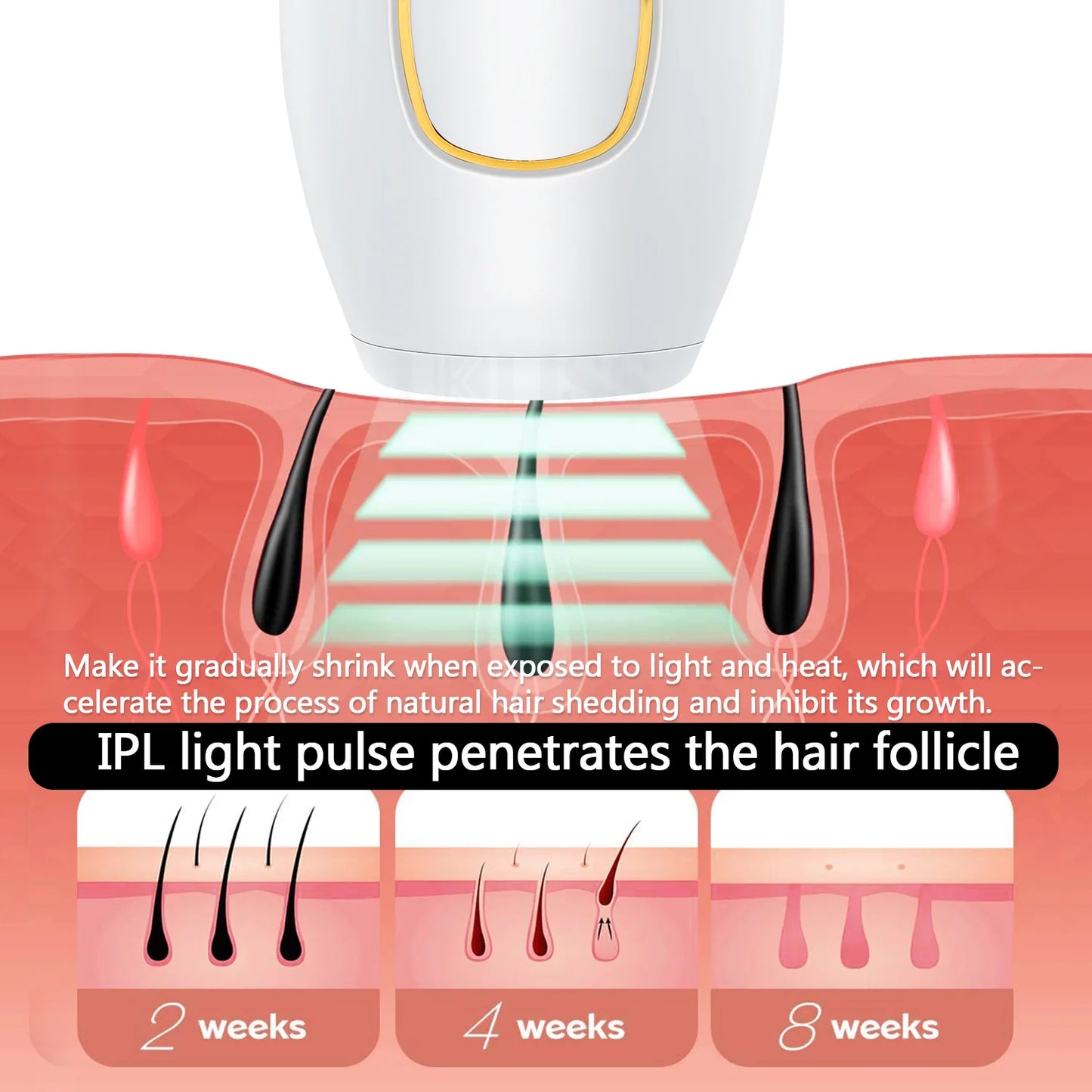 ليزر إزالة الشعر IPL